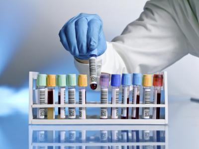 Researcher's hand pulling test tube