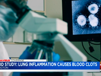 LEX18 Covid-19 Blood Clot Story