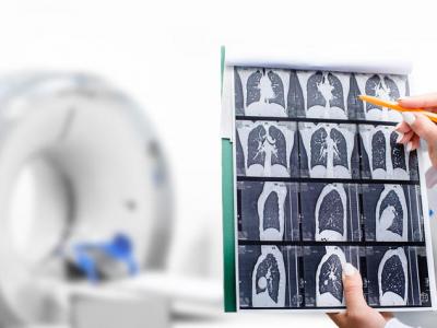 In the front left of the frame we see chest xrays indicating possible lung cancer. Hands intruding from outside the frame hold the films and point to them with a pencil. 