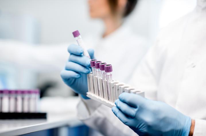 Close-up shot of hands in blue gloves handling a rack of test tubes in a lab. 