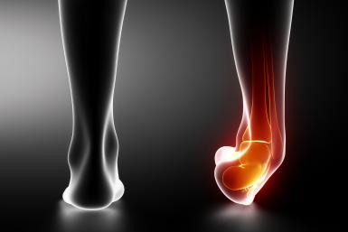 Sprained right ankle