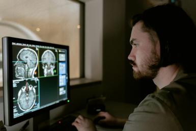 Parkinson’s Disease