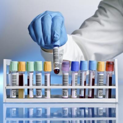 Researcher's hand pulling test tube